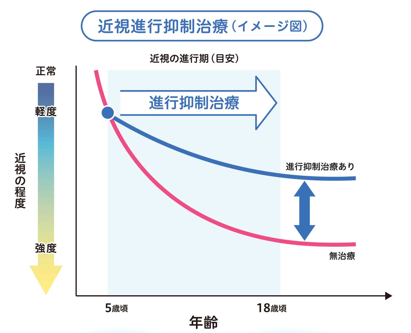 近視進行抑制治療のイメージ図